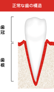 矯正の副作用②歯根吸収